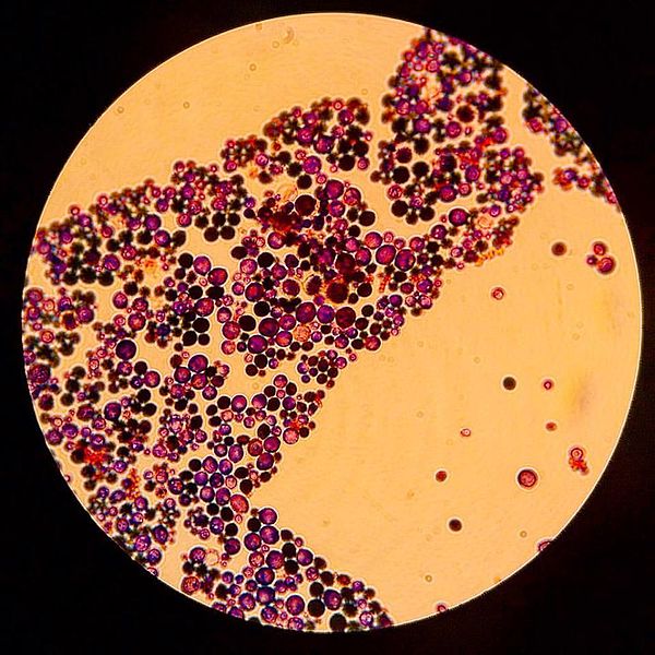 Mct's en Laurinezuur in kokosolie tegen candida, schimmelinfectie, bacteriën en virussen. Ze vervangen antibiotica