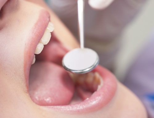 Study: Coconut oil stops tooth decay and Candida albicans by blocking Streptococcus mutans bacteria
